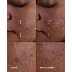 Clinique Even Better Clinical™ Dark Spot Clearing Serum 30mL