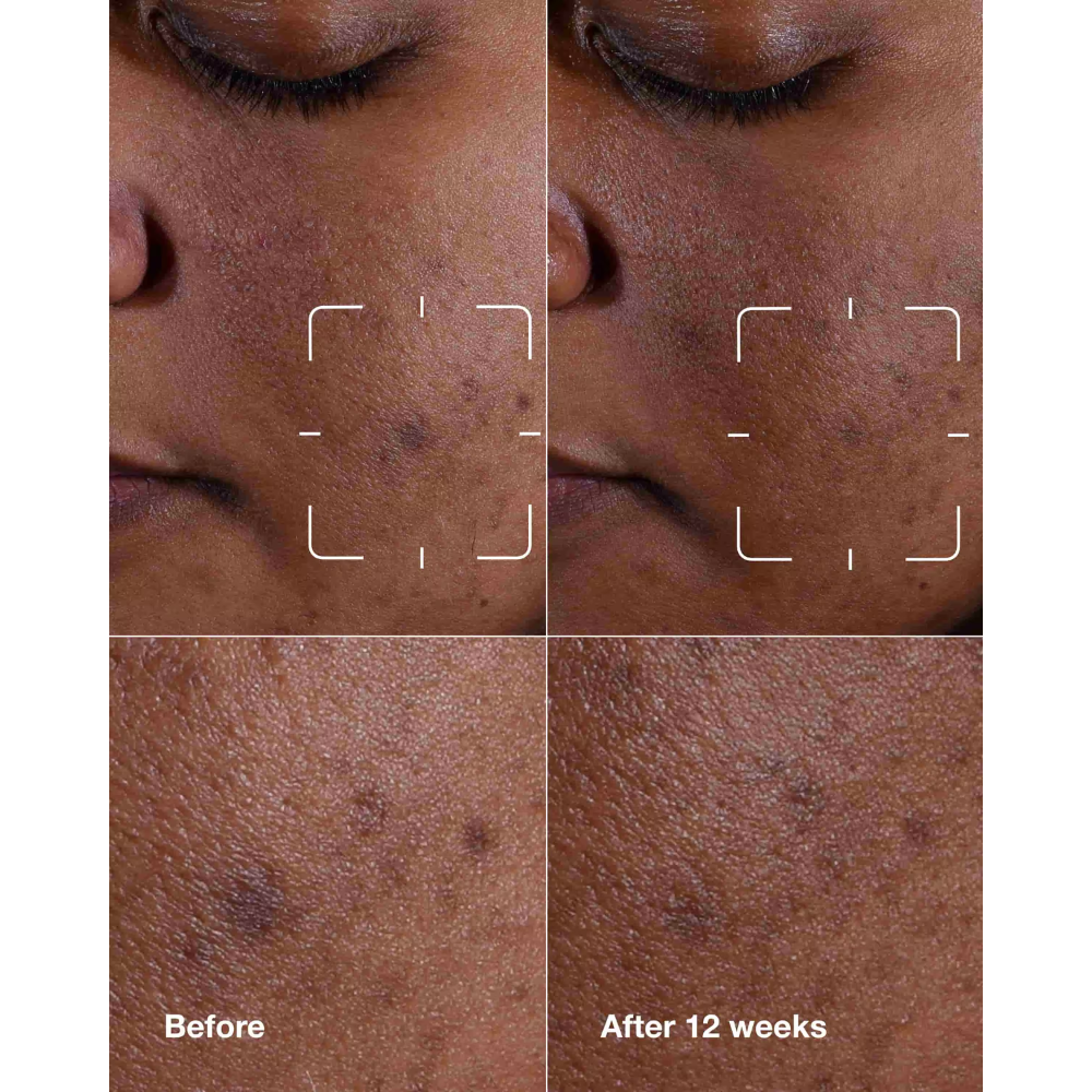 Clinique Even Better Clinical™ Dark Spot Clearing Serum 30mL