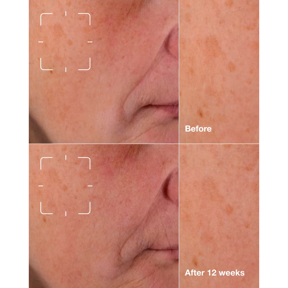 Clinique Even Better Clinical™ Dark Spot Clearing Serum 30mL